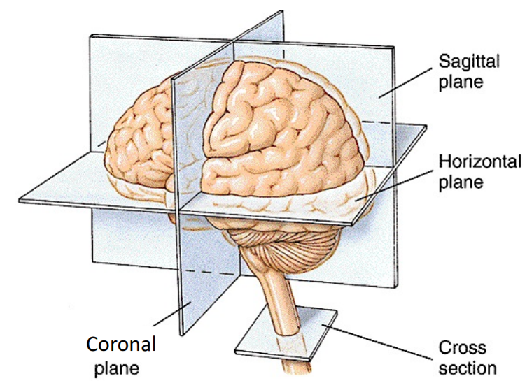 sagittal cut of brain